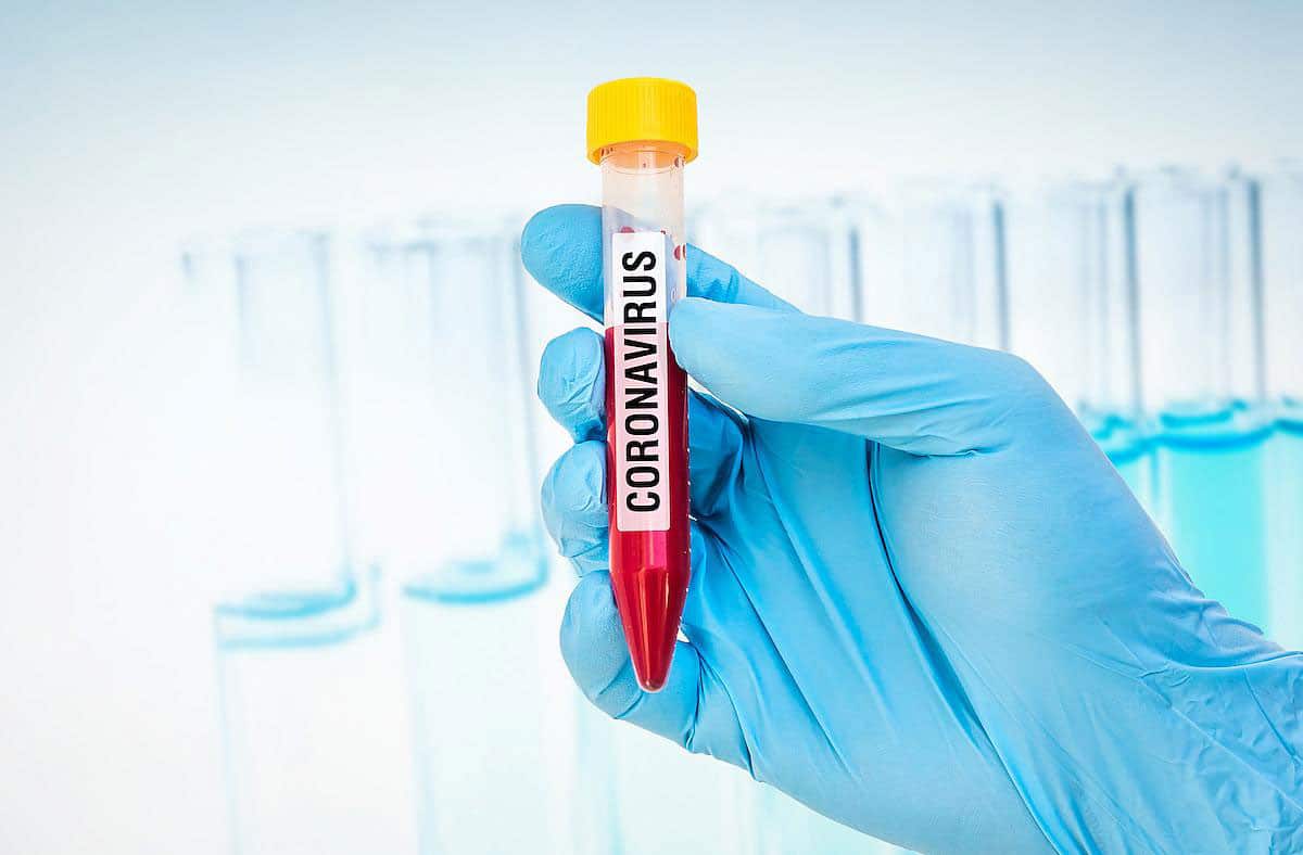 coronavirus-bloos-test